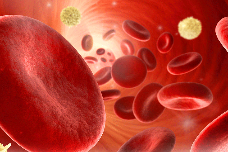 Pediatric Paget Schroetter Syndrome