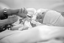 Using Brain MRI to Fight Delays in Preemies