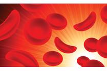 What is Sickle-Cell Disease?