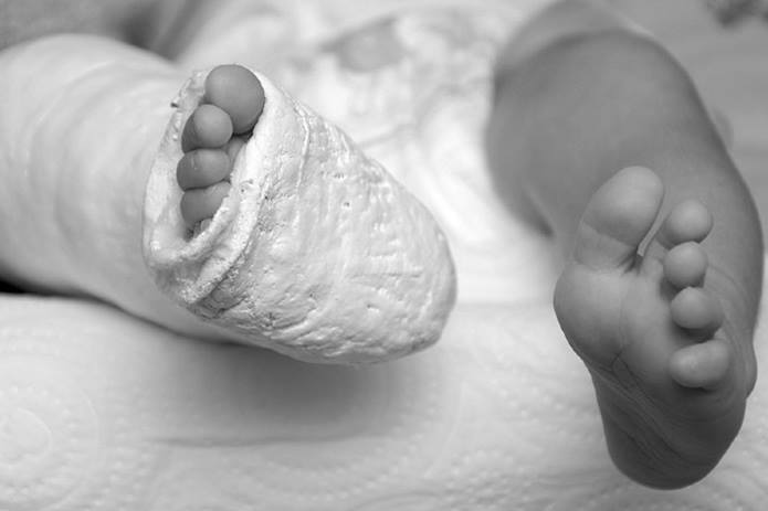 image of a child's leg and foot in a cast