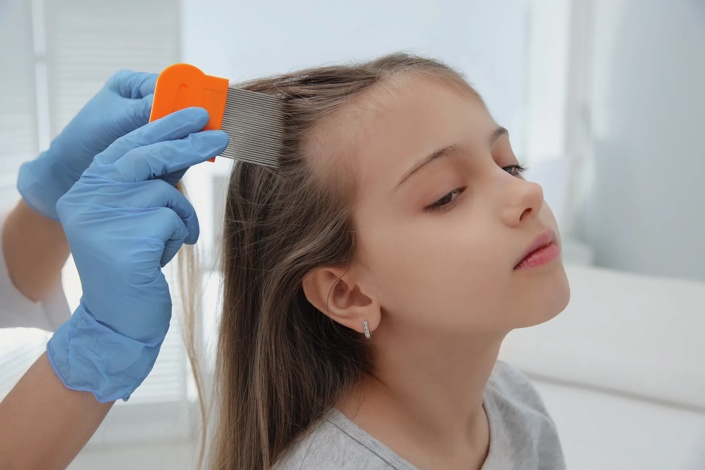 How To Get Rid Of Head Lice