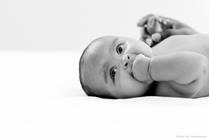 Recognizing Congenital Muscular Torticollis in Your Newborn