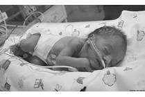 Bronchopulmonary Dysplasia (BPD): When Helping Preemies Breathe Leads to Complications