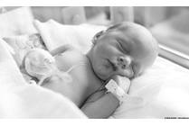 Brachial Plexus: What You Need to Know About This Childbirth Complication