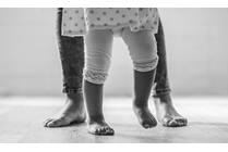 Limb Lengthening and Reconstruction: Managing Leg Discrepancy