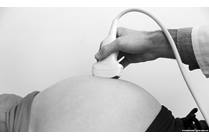 Fetal Echocardiogram: Cardiologists Evaluating Tiny Hearts
