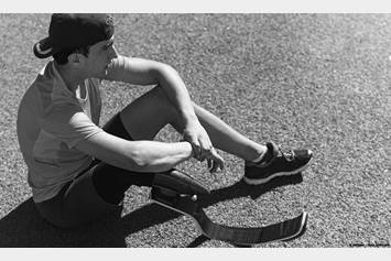 image of athlete with lower limb loss