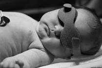 Infant Jaundice: What Is It and How Is It Treated?
