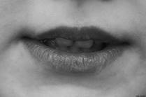 How to Treat and Prevent Chapped Lips