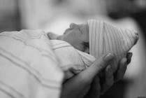 Tongue Tie: Breastfeeding, Speech and a Tethered Tongue