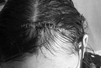 5 Things I’ve Learned as a Cancer Survivor and Physician
