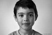 Thyroid Issues in Kids