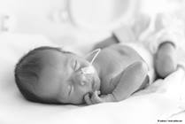 Short Bowel Syndrome: Causes, Treatment, and Diet