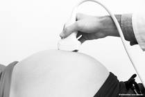 What is Gastroschisis?