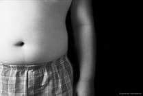 New Obesity Guidelines for Children and Adolescents