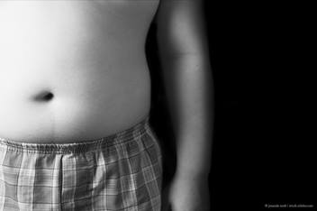 obesity guidelines