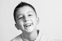 Early Phase Orthodontic Treatment: What Parents Need to Know