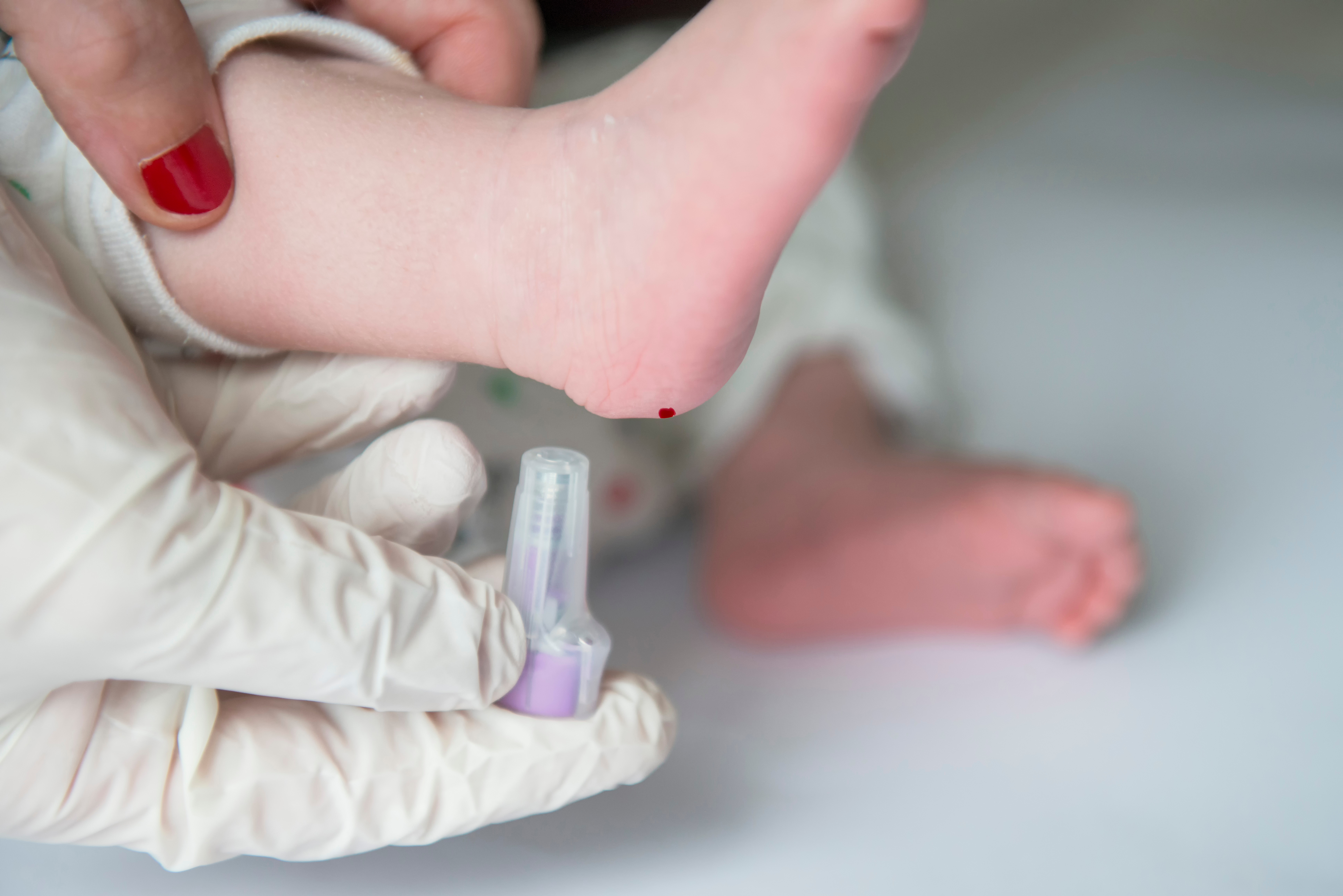 physician screening newborn for cystic fibrosis
