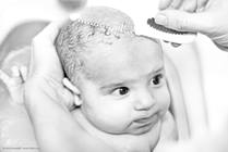 Understanding Cradle Cap: A Guide for Parents and Caregivers