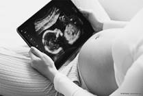 Fetal Teratomas: Frequently Asked Questions