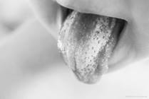 Thrush and Diaper Rash: Common Infections Caused by Candida