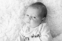 Understanding Baby Acne: A Guide for Parents
