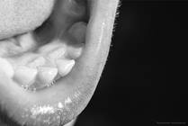 What Are "Shark Teeth"?