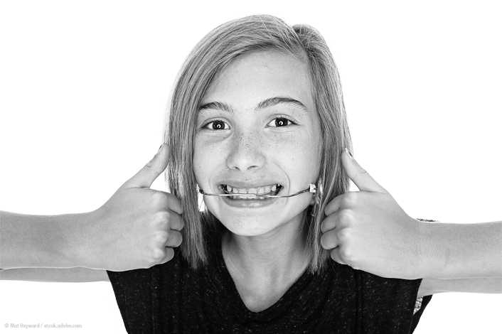 What Are Headgear and Facemasks in Orthodontics?