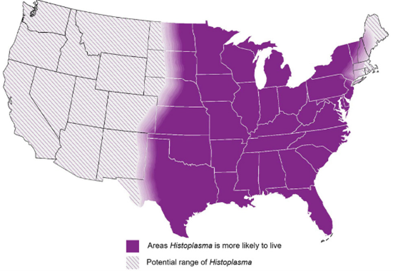 Map of the United States showing regions where Histoplasma, the fungus that causes histoplasmosis, is most commonly found.