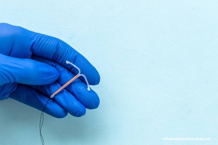 hand with blue glove on holding an IUD