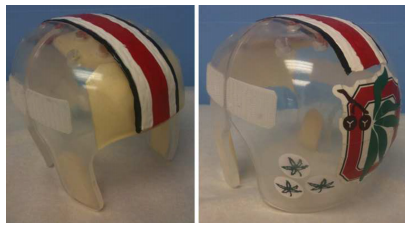 Craniosynostosis Causes Symptoms Diagnosis And Treatment