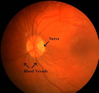 normal eye