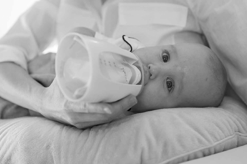 Baby With Feeding Disorder