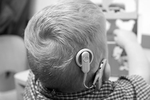 Cochlear Implants
