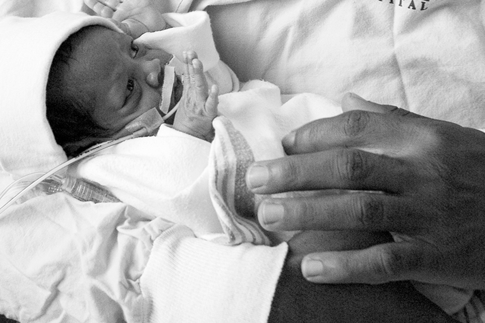 Persistent Pulmonary Hypertension Of The Newborn Symptoms Treatment