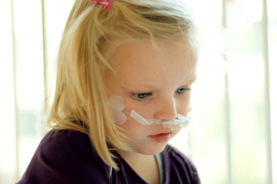 Little girl receiving oxygen therapy