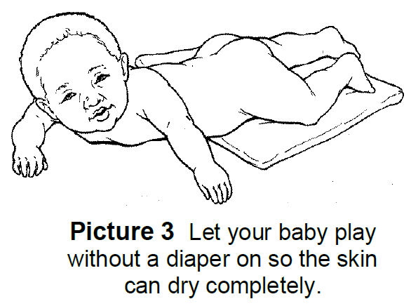 thrush in babies contagious