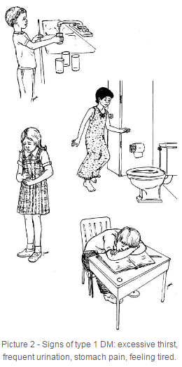 Signs of type 1 DM