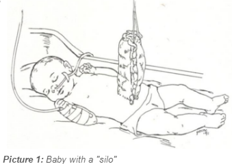 baby with a silo