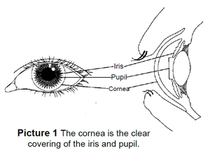 Eye Injury (Corneal Abrasion): Symptoms, Diagnosis and Treatment