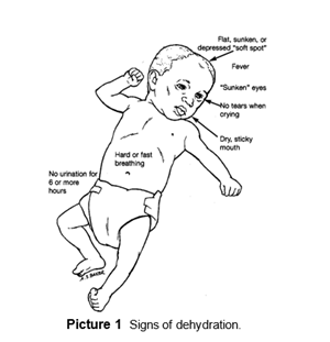 Signs of dehydration for infant