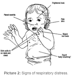 Signs of Respiratory Distress