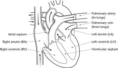 Ductus Arteriosus