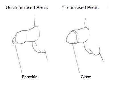 diagram of circumcised and uncircumcised penis