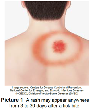 Parent checking child's skin for ticks