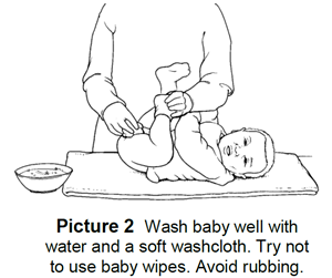 Diaper Rash