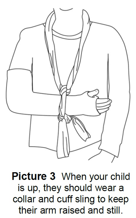 Cuff and collar on child's right arm