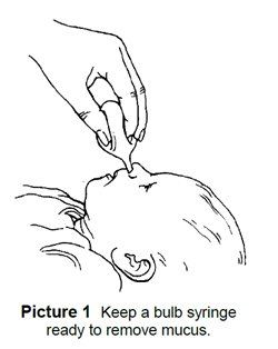 bulb syringe being used to remove mucus from baby's nose