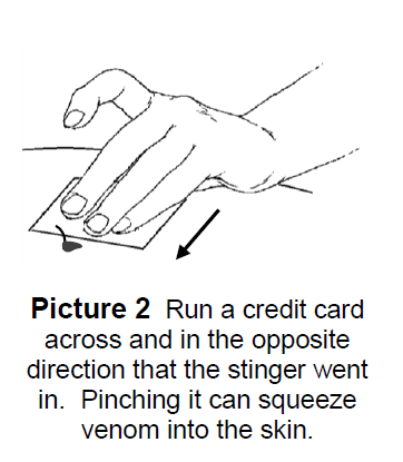 Run a credit card across and in the opposite direction that the stinger went in. Pinching it can squeeze venom into the skin.