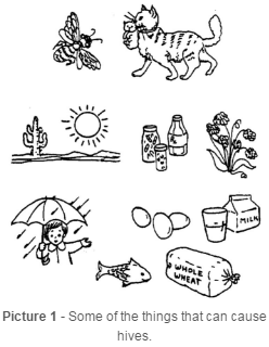 Some of the things that can cause hives